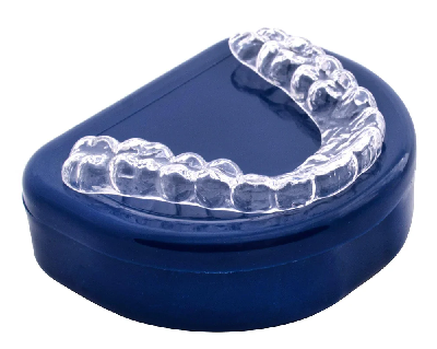 Example of a mouth guard to battle Bruxism